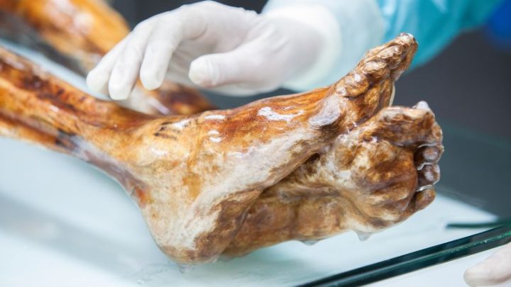 Ötzi the Iceman is long dead, but some of his ancient microbes are still alive