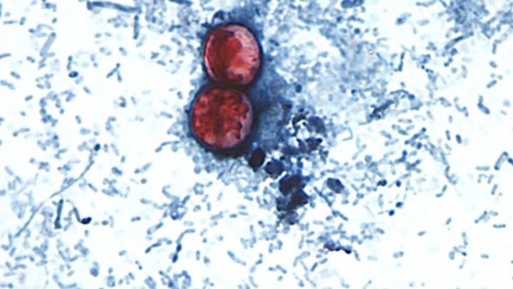 Michigan says diarrhea outbreak may be linked to lettuce and salad greens as cases rise above 3,000
